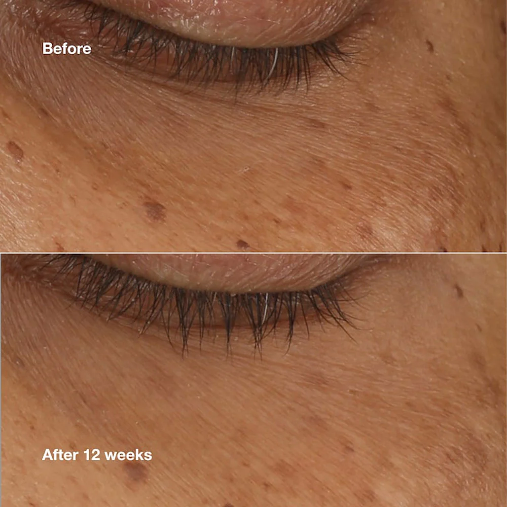 All About Eyes Brightening Serum Concentrate - Image 2