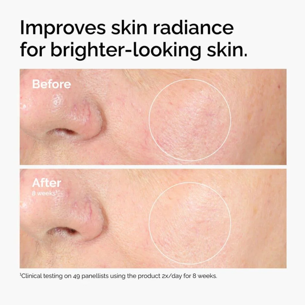 The Ordinary Alpha Arbutin 2% + HA - Image 4