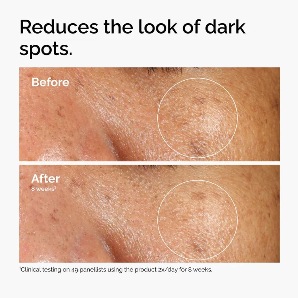 The Ordinary Alpha Arbutin 2% + HA - Image 5