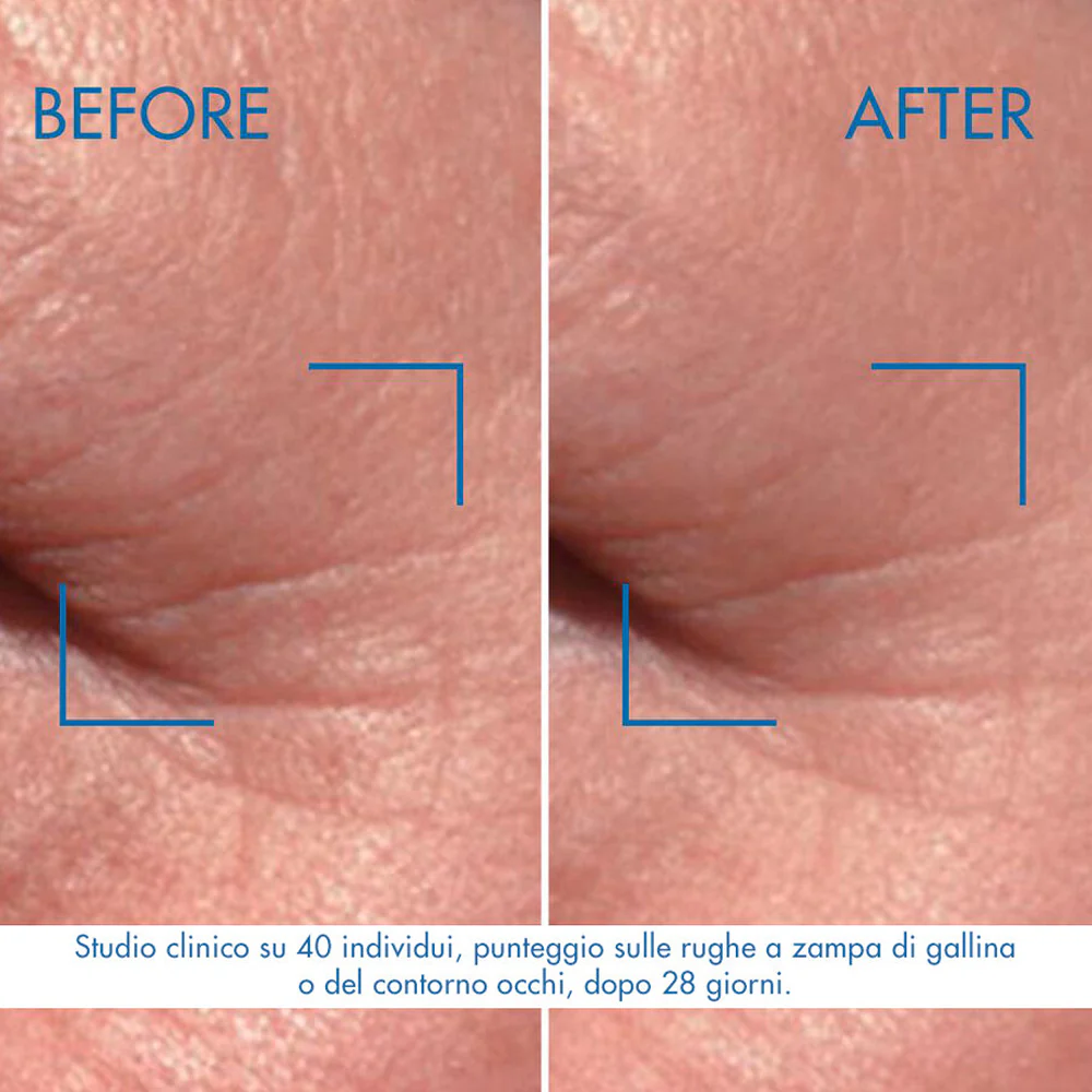 Blue Pro-Retinol - Image 7