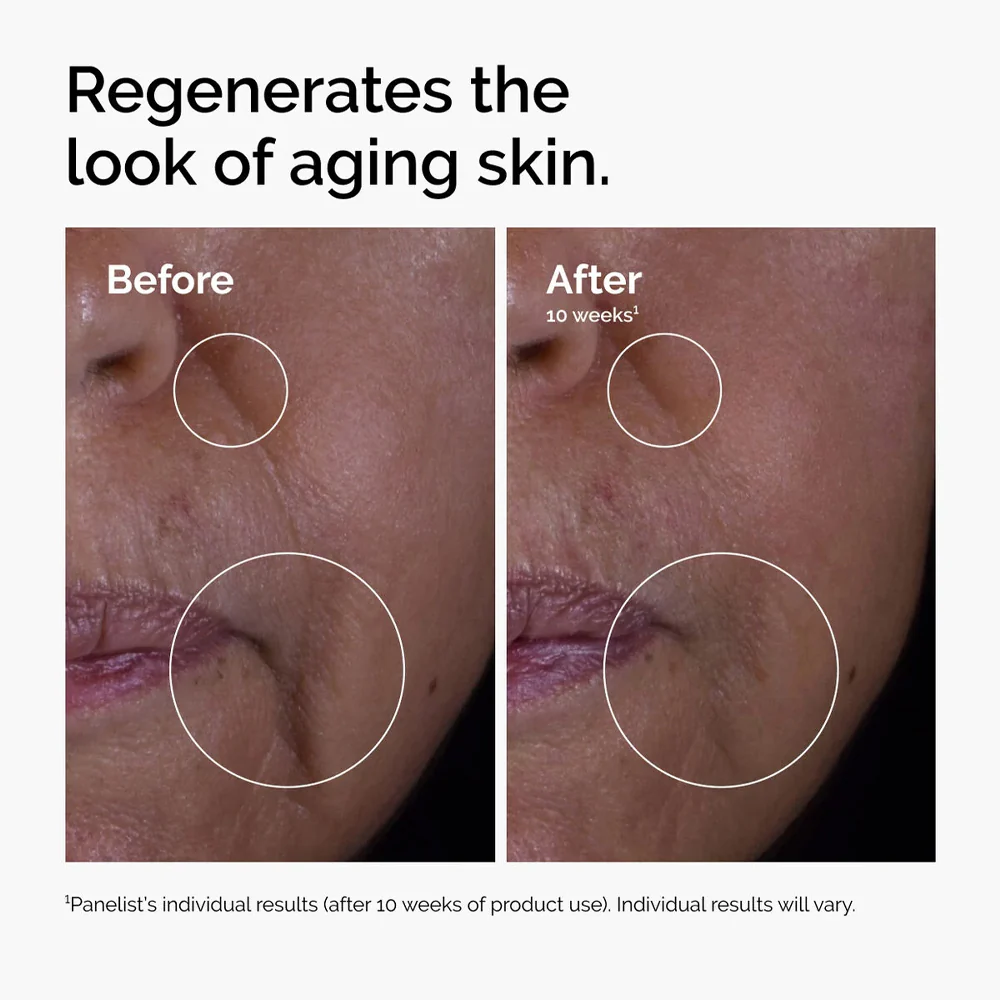 The Ordinary GF 15% Solution - Image 4