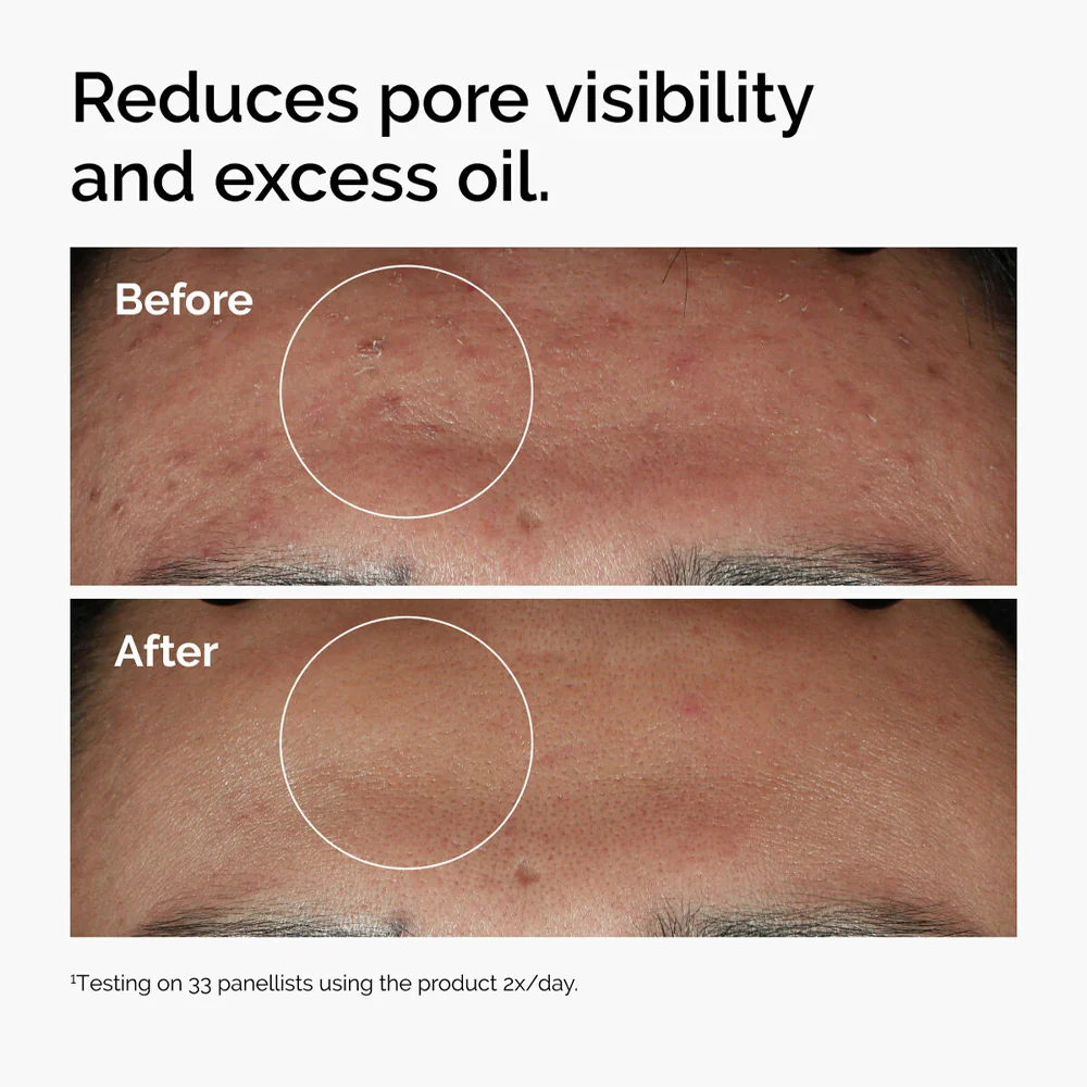The Ordinary Niacinamide 10% + Zinc 1% - Image 9