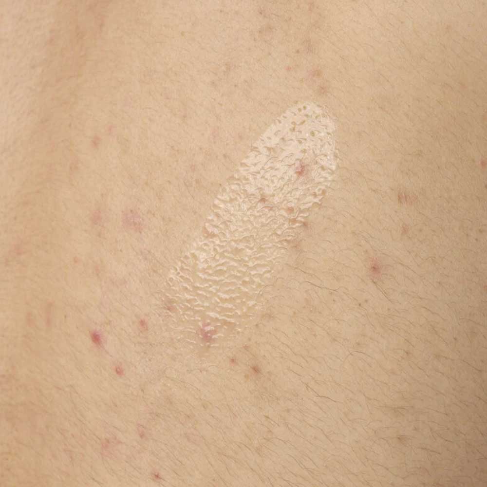 The Ordinary Salicylic Acid 0.5% Body Serum - Image 3