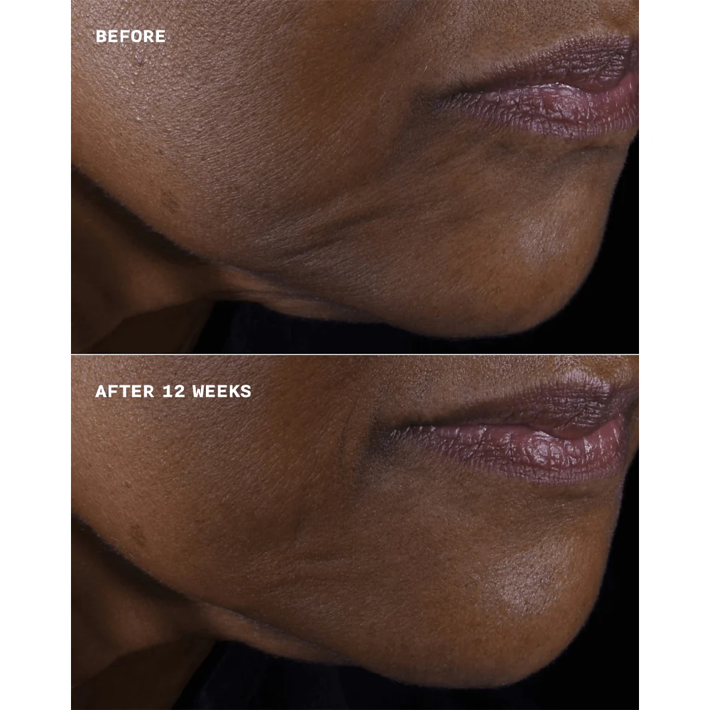 Smart Clinical Repair Lifting Face + Neck Cream - Image 3