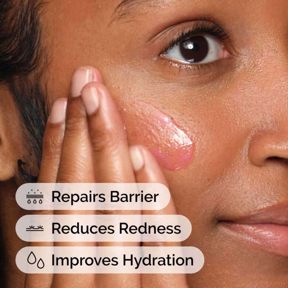 The Ordinary Soothing & Barrier Support Serum - Image 3
